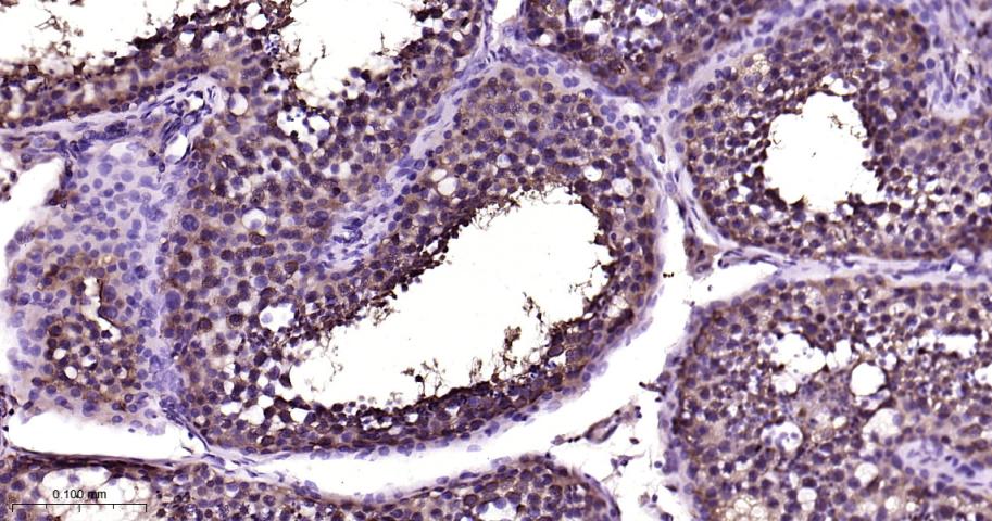 14 - HSP70 Recombinant Rabbit mAb AP94455