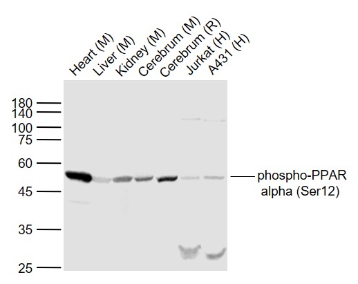 1 - phospho-PPAR alpha (Ser12) Rabbit pAb AP94506
