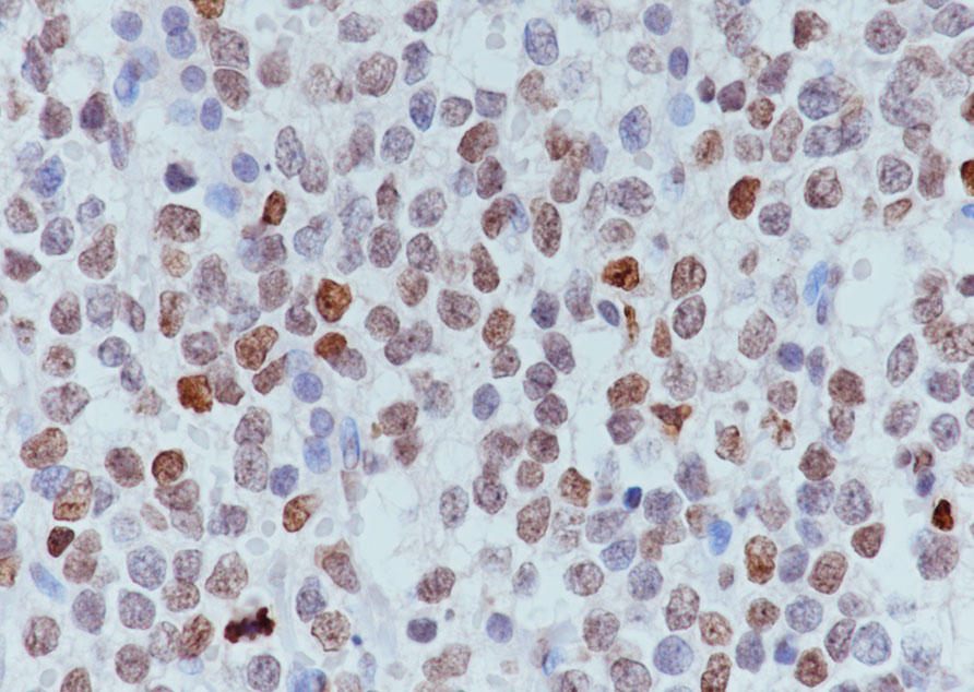 14 - Histone H3 (tri methyl K9, phospho S10) Rabbit pAb AP94511