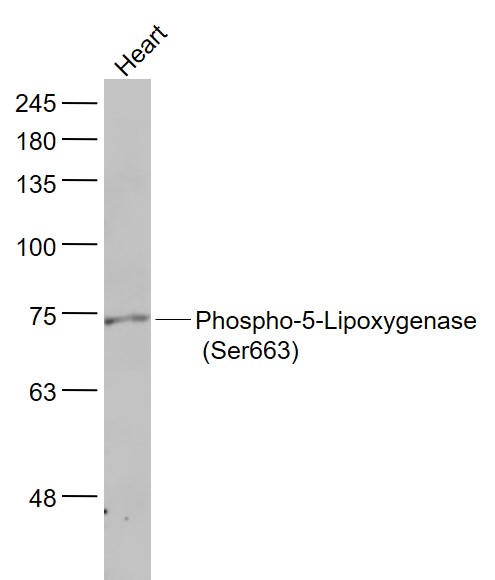 1 - phospho-ALOX5 (Ser663) Rabbit pAb AP94530