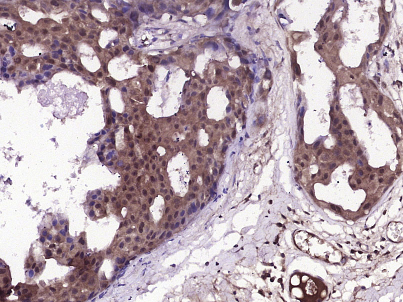 14 - phospho-HSP70 (Tyr41) Rabbit pAb AP94565
