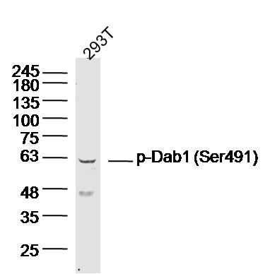 1 - phospho-Dab1 (Ser491) Rabbit pAb AP94689