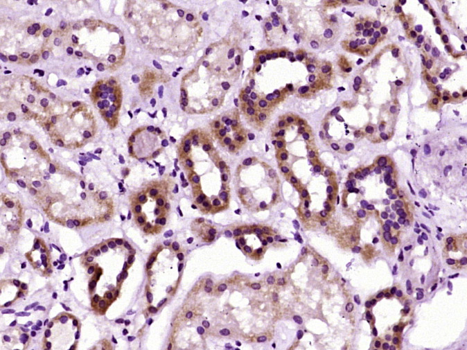 14 - CRK Rabbit pAb AP94691