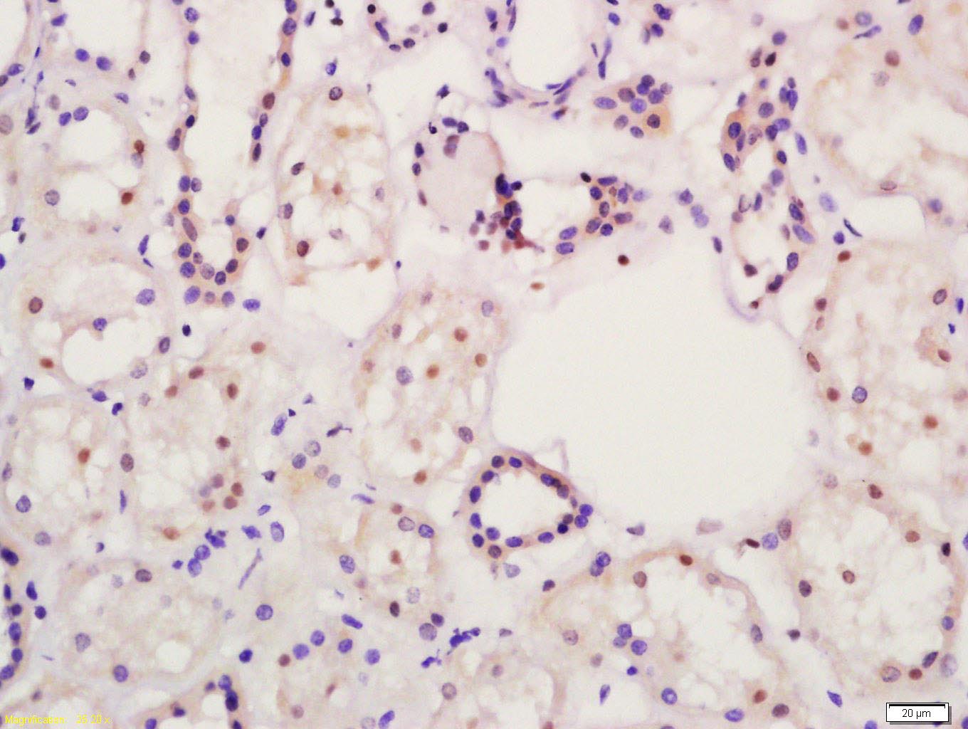 14 - PPAR alpha Rabbit pAb AP94743