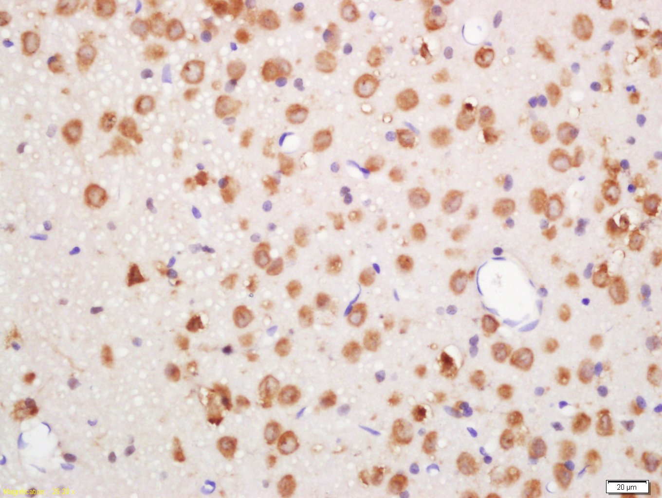 14 - phospho-Erk1 (Thr202 + Tyr204) Rabbit pAb AP94745