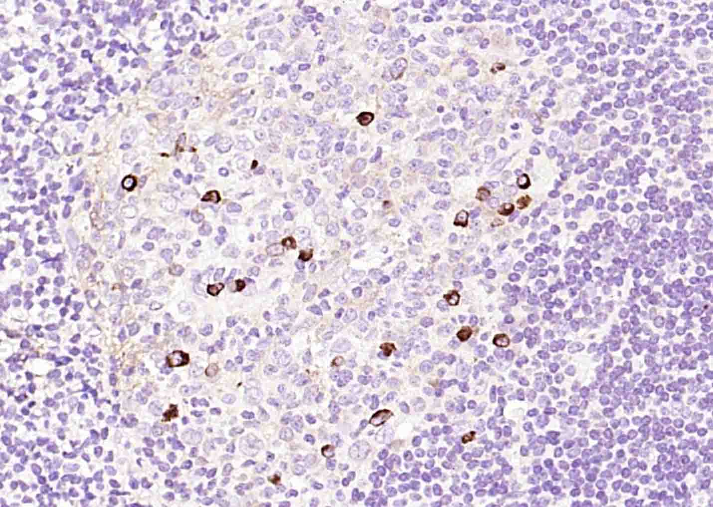 14 - Human IgM Mouse mAb AP94772