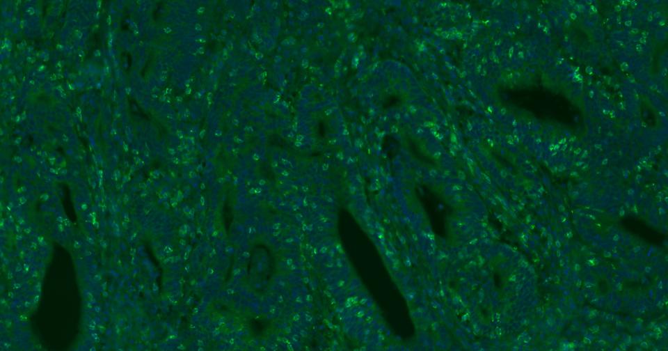 3 - CD8 Recombinant Rabbit mAb AP94821