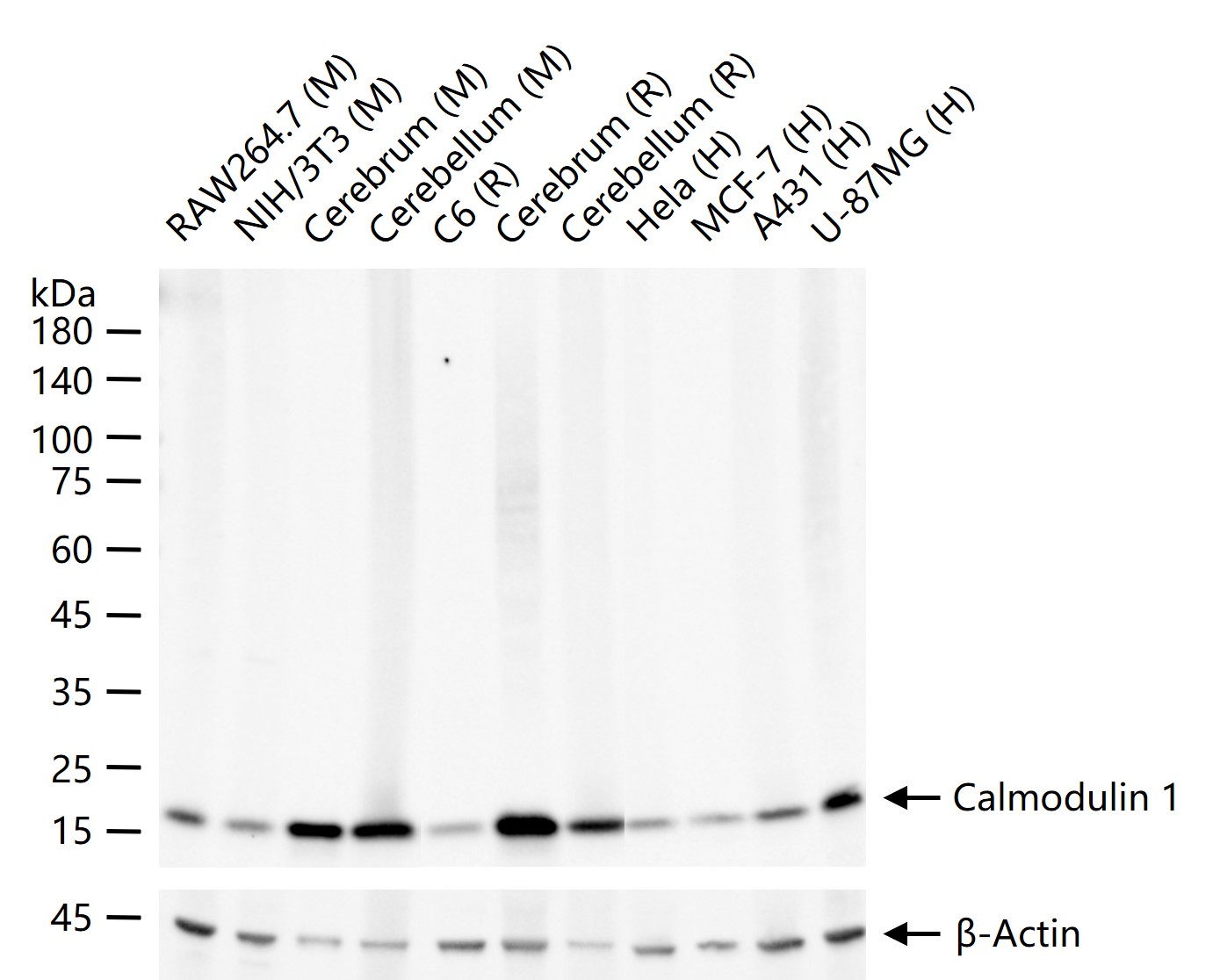1 - Calmodulin 1 Recombinant Rabbit mAb AP94823