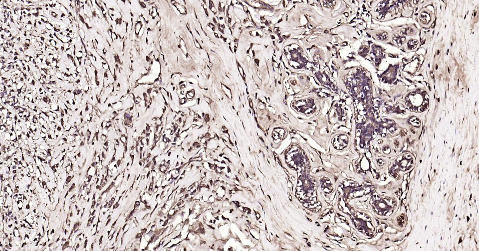 14 - Calmodulin 1 Recombinant Rabbit mAb AP94823