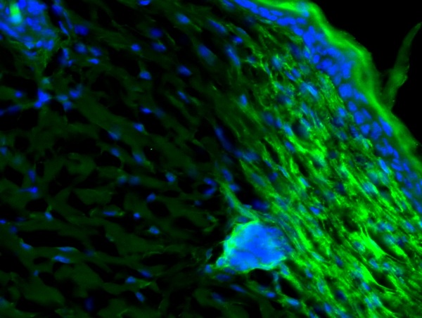 3 - CXCL10/IP10 Rabbit pAb AP94832