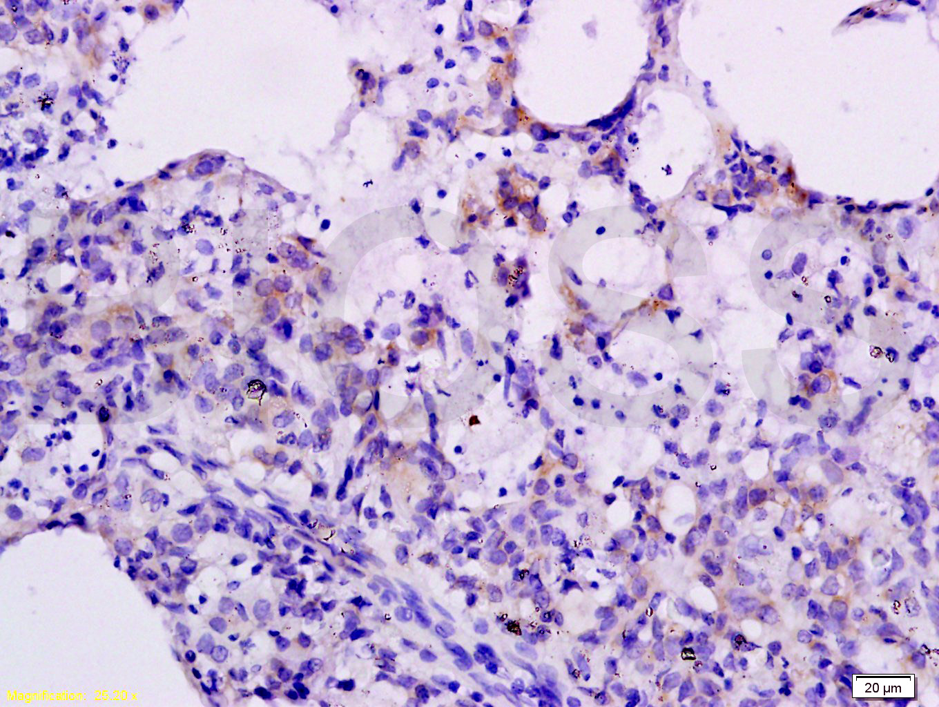 14 - CXCL10/IP10 Rabbit pAb AP94832