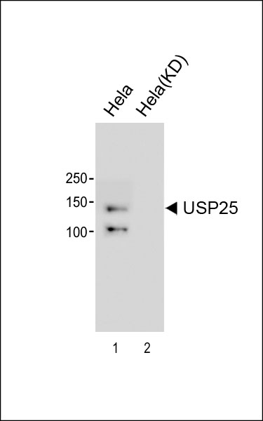 1 - USP25 Antibody [Knockdown Validated] AM2255a