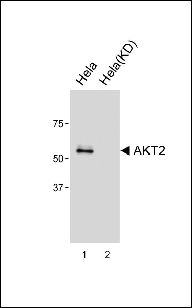 1 - AKT2 Antibody [Knockdown Validated] AM8523b