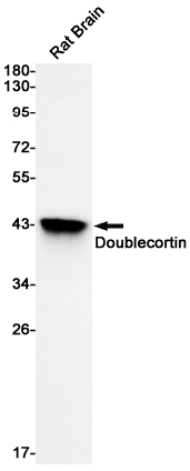 1 - Doublecortin Rabbit mAb AP74820