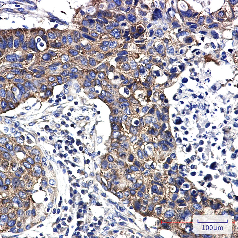 2 - FMRP Rabbit mAb AP74821