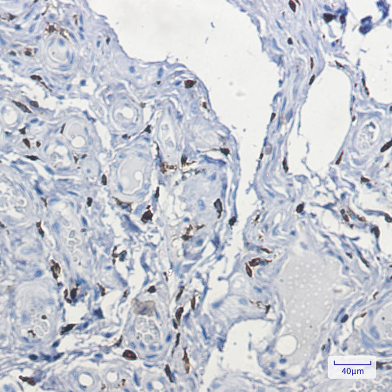 2 - Factor XIIIa Rabbit mAb AP74844