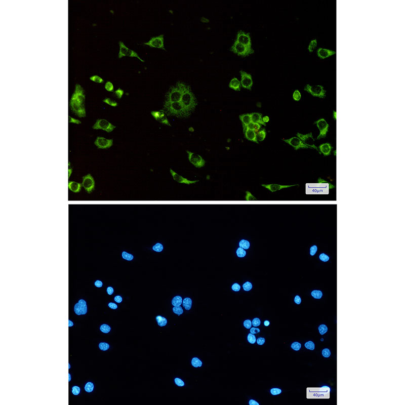 8 - ATP Synthase C Rabbit mAb AP74845