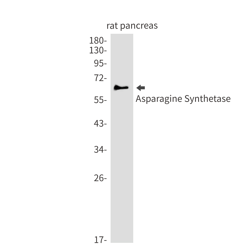 1 - Asparagine Synthetase Rabbit mAb AP74856