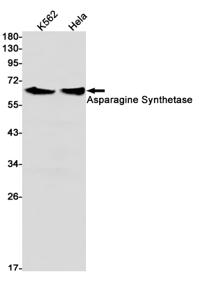 2 - Asparagine Synthetase Rabbit mAb AP74856