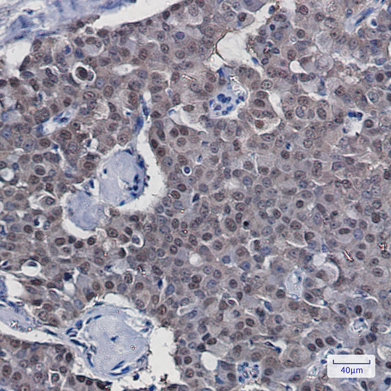 8 - COPS8 Rabbit mAb AP74864