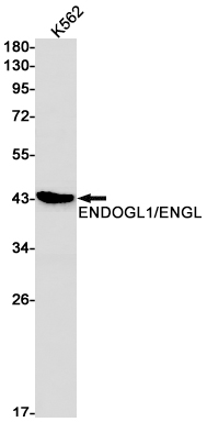 1 - ENDOGL1 Rabbit mAb AP74866