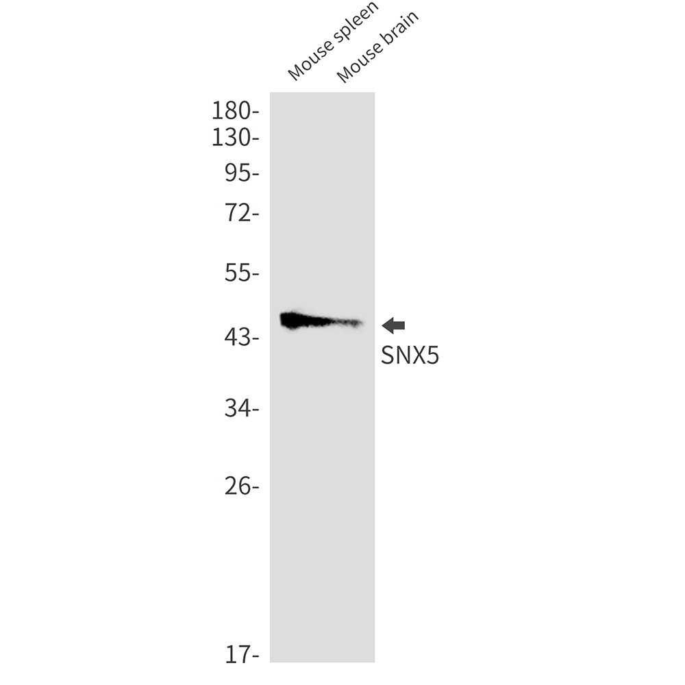 2 - SNX5 Rabbit mAb AP74878