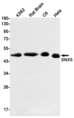 8 - SNX5 Rabbit mAb AP74878