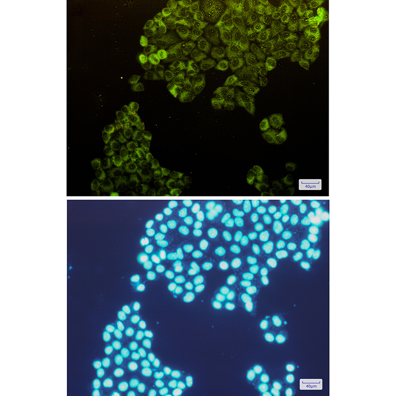 8 - PFKM Rabbit mAb AP74879