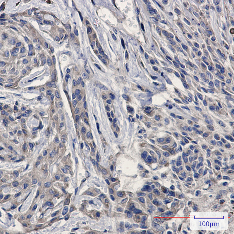 2 - Amyloid Precursor Protein Rabbit mAb AP74896