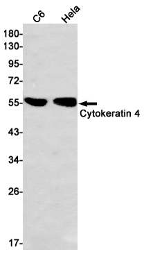 1 - Cytokeratin 4 Rabbit mAb AP74899