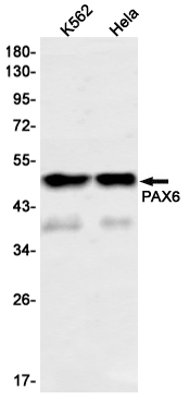 1 - PAX6 Rabbit mAb AP74902