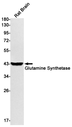 2 - Glutamine Synthetase Rabbit mAb AP74913