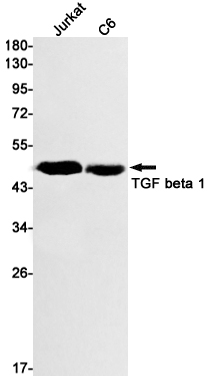 0 - TGF beta 1 Rabbit mAb AP74925