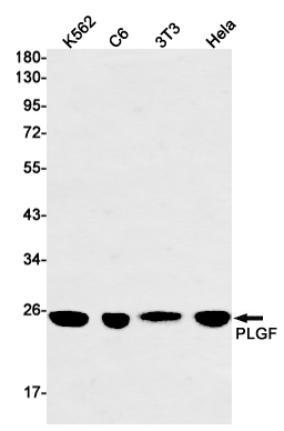1 - PLGF Rabbit mAb AP74929