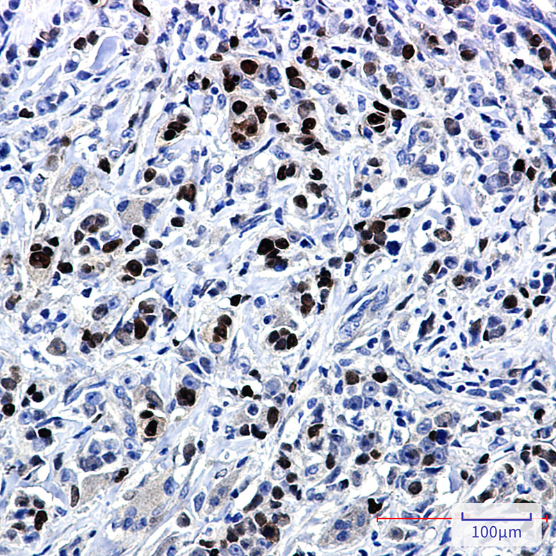 8 - SOX9 Rabbit mAb AP74952