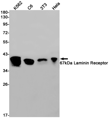 1 - 67kDa Laminin Receptor Rabbit mAb AP75019