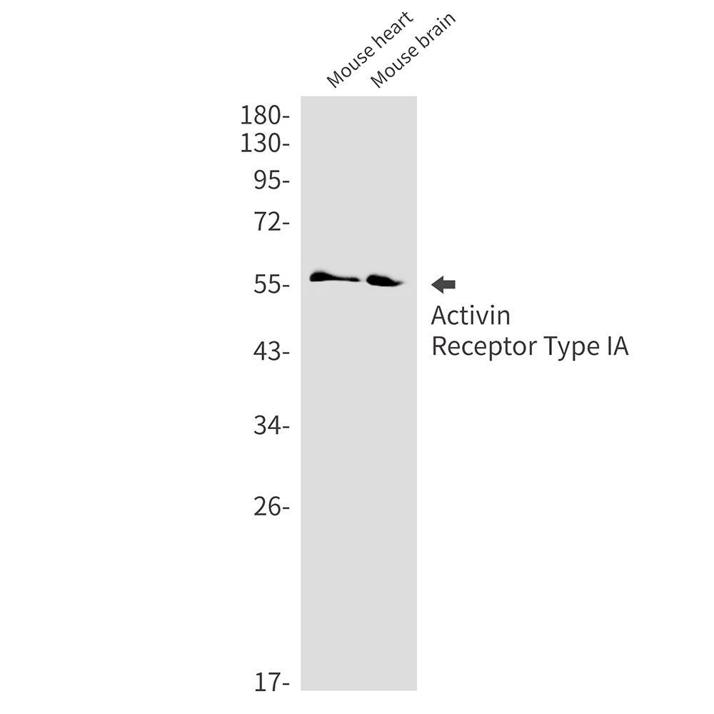 1 - ACVR1  Rabbit mAb AP75033
