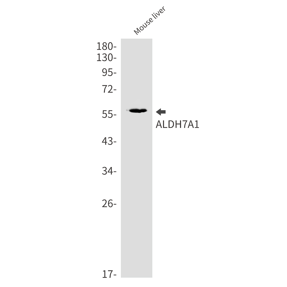 1 - ALDH7A1 Rabbit mAb AP75050