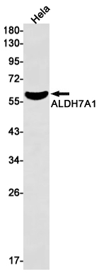 2 - ALDH7A1 Rabbit mAb AP75050
