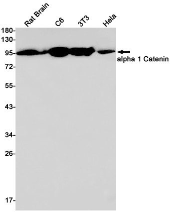 1 - CTNNA1 Rabbit mAb AP75058