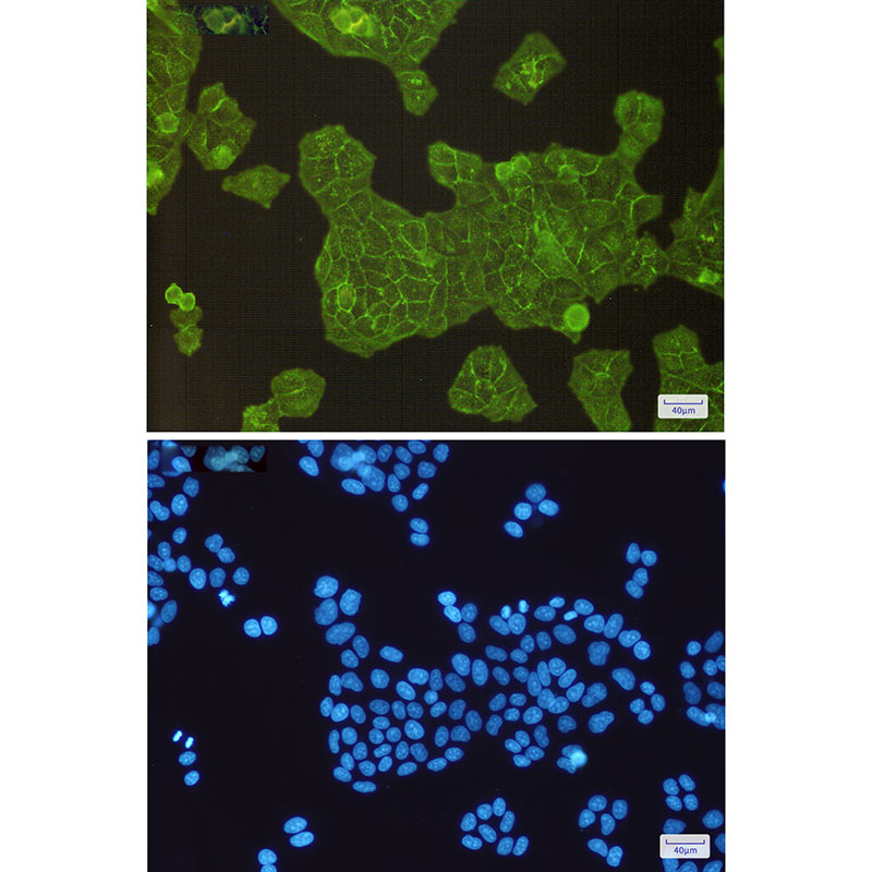 2 - alpha Actinin 4 Rabbit mAb AP75060