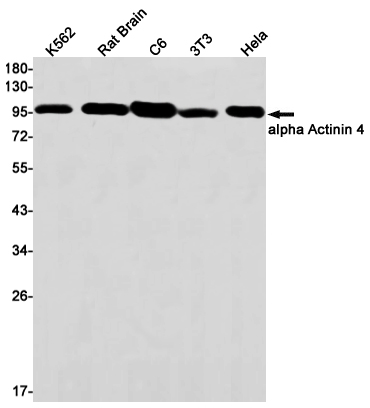 1 - alpha Actinin 4 Rabbit mAb AP75060