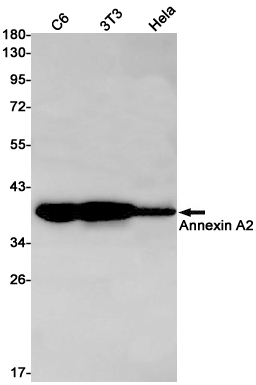 1 - Annexin 2 Rabbit mAb AP75078