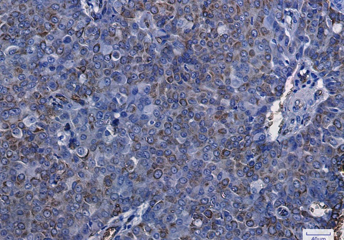 2 - Aquaporin 1 Rabbit mAb AP75096