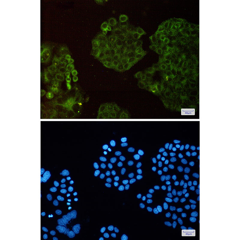 8 - Arp3 Rabbit mAb AP75104