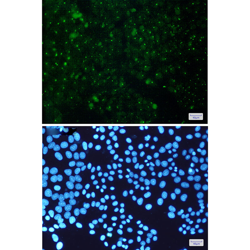 8 - Aryl hydrocarbon Receptor Rabbit mAb AP75108