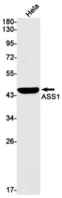 2 - ASS1 Rabbit mAb AP75113