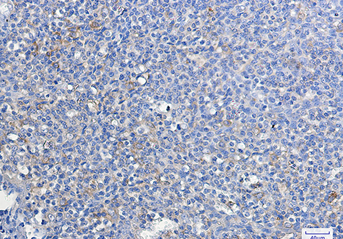 8 - ATG3 Rabbit mAb AP75119