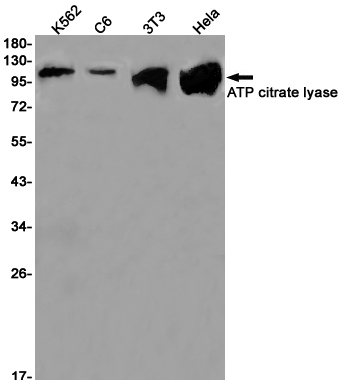 8 - ATP Citrate lyase Rabbit mAb AP75124
