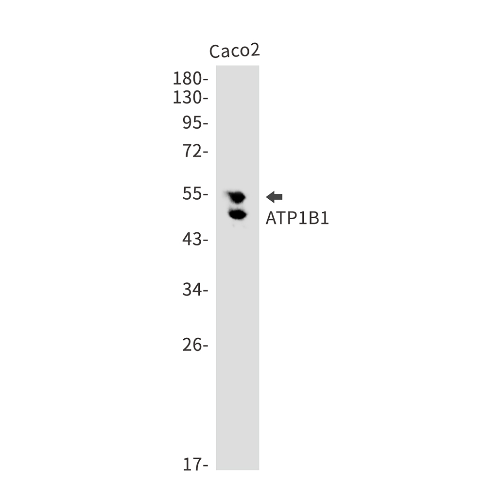 1 - ATP1B1 Rabbit mAb AP75125